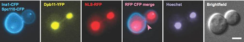 pictures of anaphase bridges 